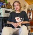 Maria Kovalchuk aparece com cicatriz na testa em entrevista  Foto: Reprodução/Novosti