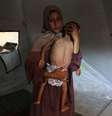 Mãe segura bebê de 18 meses com sinais de desnutrição em campo de refugiados em Gaza  Foto: ANSA / Ansa - Brasil