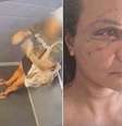 Juliana Soares mostra como está o rosto após cirurgia de reconstrução  Foto: Reprodução/Redes sociais/@juhhhsoares