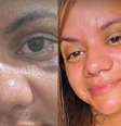 Agredida pelo namorado com 61 socos no elevador de seu prédio, Juliana Soares mostrou o resultado da cirurgia reparadora  Foto: Reprodução, TikTok / Purepeople