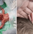 Henrique, atualmente com 10 meses, é considerado um verdadeiro milagre por Heusiléia Coelho  Foto: Reprodução/Arquivo Pessoal