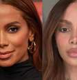 Anitta em 2024 e agora, repaginada: imprensa e fãs já perderam a conta de quantas plásticas a cantora fez  Foto: Paulo Belote/TV Globo/Divulgação e Reprodução/Instagram