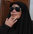 As mãos, o rosto e os olhos de Nayfe ficaram gravemente danificados no ataque com pagers  Foto: Arquivo pessoal / BBC News Brasil