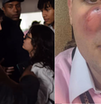 Alunos da Unifesp ficaram feridos após briga com equipe de vereador bolsonarista  Foto: Reprodução/ Redes sociais