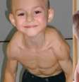 Giuliano Stroe, o menino mais forte do mundo, aos 5 anos  Foto: Foto/Reprodução / Contigo