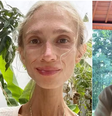 Mulher chegou a pesar somente 22 quilos  Foto: Reprodução