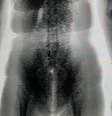 A imagem do BodyScan mostrou um volume estranho no corpo da mulher  Foto: Divulgação/Seap-BA