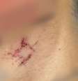 Vítima tinha várias marcas de agressões pelo corpo   Foto: Divulgação/PCGO