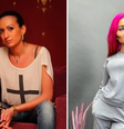 Mulher com as ‘maiores maçãs do rosto do mundo’ mostra antes e depois e choca web  Foto: Reprodução/Instagram