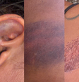 Advogada Edricélia Silva denunciar ter sido agredida por PMs na madrugada do último domingo, 30, durante a Festa do Caju, em Serra do Mel  Foto: Arquivo Pessoal