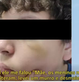 Menino brasileiro de 13 anos foi agredido em escola em Portugal  Foto: Reprodução/ Record News