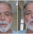 Após passar por transplante de rim, Claudio Cinti faz pedido por doações  Foto: Reprodução/Instagram/@claudiocintiator