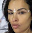 Ex  Foto: BBB Ariadna Arantes é submetida a cirurgia em São Paulo - Reprodução/Instagram / Contigo