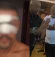 Homem foi agredido na noite de sábado, 10, em um quiosque na Avenida Presidente Castelo Branco, em Praia Grande.  Foto: Reprodução/Rede Social / Estadão