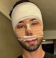 Rico Melquíades já modificou várias partes do corpo após sofrer cruel pressão sobre a aparência  Foto: Reprodução