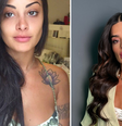 Antes e depois: veja a transformação do rosto de Aline Campos  Foto: Reprodução/Instagram