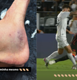 Zagueiro do Corinthians, Gustavo Henrique revela ferimento e ironiza decisão da arbitragem em duelo contra o Santos   Foto: Reprodução/Redes Sociais