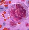 A leucemia é um câncer das células brancas do sangue, os leucócitos – depositphotos.com / forfour  Foto: Giro 10