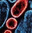 Colorised transmission electron micrograph of mature extracellular Nipah virus particles (red) near the periphery of an infected VERO cell (blue)  Foto: Universal Images Group/Getty Images / BBC News Brasil