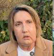 Carmen teve uma grave infecção que desfigurou o rosto  Foto:  Reprodução/Hospital Vall d'Hebron