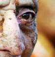 As vítimas de intoxicação por Nemagon na Nicarágua sofreram infertilidade, insuficiência renal crônica, doenças de pele ou câncer  Foto: DW / Deutsche Welle