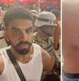 João Vitor sendo conduzido por policiais | Imagem do exame de corpo de delito  Foto: Imagens concedidas ao Terra