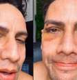 Arquiteto é xingado e agredido no carnaval de Olinda  Foto: Reprodução/Instagram/@augustomendoncarecife