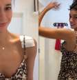 Alane mostra machucados após uso do costeiro em desfile  Foto: Reprodução/TikTok/@alanediax