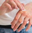 Conheça os sintomas e tratamentos da Mpox  Foto: Freepik