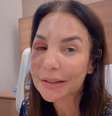 Ivete Sangalo atualiza estado de saúde  Foto: Reprodução/Instagram