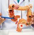 Rastreamento precoce e hábitos saudáveis aumentam a chance de cura e reduzem mortes por câncer colorretal  Foto: sasirin pamai | Shutterstock / Portal EdiCase
