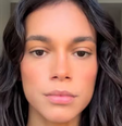 Alane Dias é atropelada por moto  Foto: Reprodução/Instagram