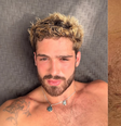 João Guilherme passa por remoção de tatuagens com tratamento a laser  Foto: Reprodução: Redes Sociais / Saúde em Dia