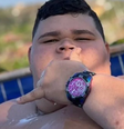 É grave? Influenciador Gordão da XJ passa por cirurgia delicada / Reprodução: Instagram  Foto: Contigo