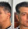 Maurício Mattar, antes e depois  Foto: Reprodução | Instagram