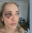 Ana Cristina Durão Nunes foi agredida por motociclista de aplicativo   Foto: Reprodução/TV Globo