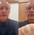 Jornalista precisou de quatro pontos na mão  Foto: Reprodução/Instagram
