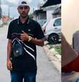 Guilherme Torres da Silva sofreu por dez meses as sequelas da intoxicação por metanol  Foto: Reprodução/curadometanol/Instagram