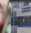 Criança levou 13 pontos no braço após incidente  Foto: Montagem: Reprodução e Google Street View
