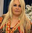 Monique Evans revela desejo de fazer minilifting; especialistas explicam quando a técnica é indicada  Foto: Reprodução / Perfil Brasil