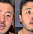 Ricardo Akira foi agredido por desconhecido em vagão de metrô em SP  Foto: Reprodução