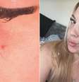 Ferida que não cicatriza  Foto: SaúdeLAB