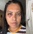 Influencer Carla Lemos é agredida em roda de samba no Rio  Foto: Reprodução/Instagram/Carlinha