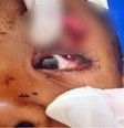 Menino de 6 anos atingido em tiroteio no RJ perde a visão do olho esquerdo  Foto: Reprodução/ TV Globo 