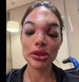 A cirurgiã-dentista Giullia Falcão afirma ter sido agredida pelo marido, o empresário Ivo Kos, que foi preso. Foto: Reprodução/@dragiufalcao via TikTok / Estadão