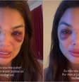 Giulia Falcão Kos desabafa sobre agressão e tentativa de feminicídio  Foto: Reprodução/Instagram