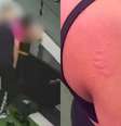 Aluna denunciou assédio após ser agarrada e mordida por instrutor em academia da Zona Norte do Recife  Foto: Reprodução/Redes sociais 