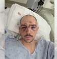 Jadon partilhou que teve medo de morrer, dado a gravidade de seus ferimentos, mas suas filhas o fizeram lutar pela vida  Foto: Reprodução/Redes Sociais