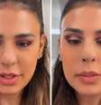 Simone Mendes interage com seguidores e fala sobre cirurgia estética   Foto: Reprodução Instagram | @simonemendes