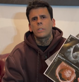 Leandro iniciou o processo de remoção de tatuagens em 2024   Foto: Reprodução/Instagram/@leandrodesouzabless